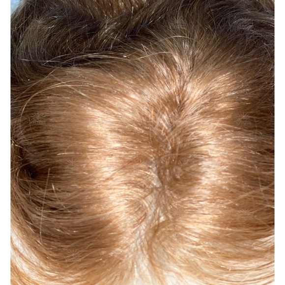 HD Film Topper / Toupee with virgin blonde hair - Picture 8 of 9